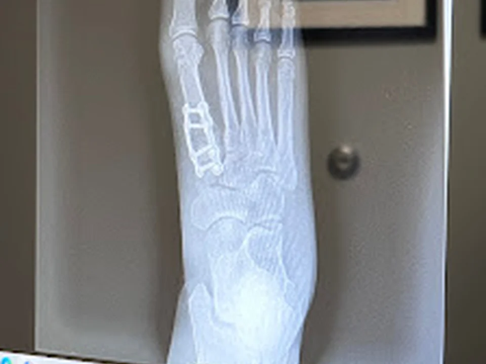 Issaquah Foot & Ankle Specialists, Seattle