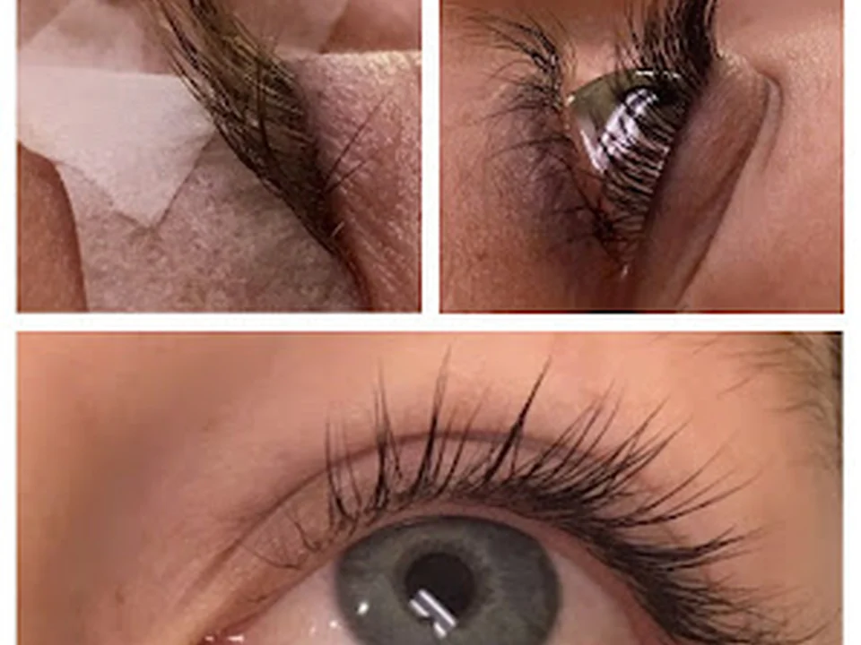 SWIFT Hair Removal, Seattle